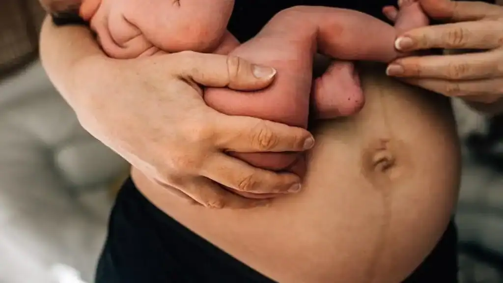 Why Is My Stomach Still Big After Pregnancy Elgin?